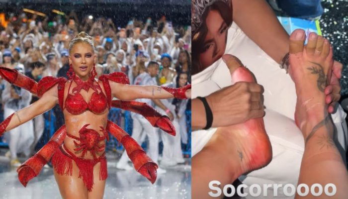 Virginia mostra pé machucado após ensaios na Sapucaí  • Instagram/ Virginia