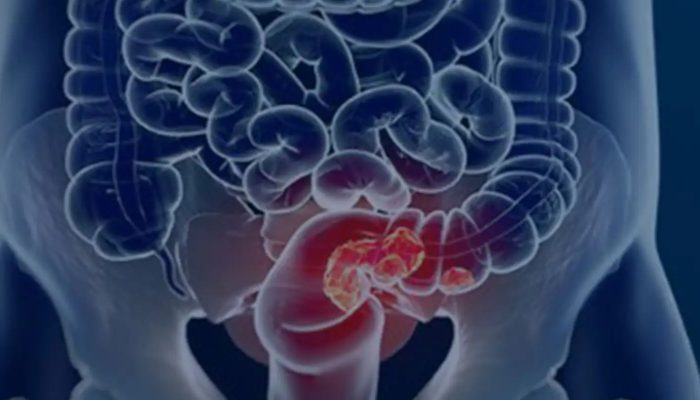 © Câmara Municipal de Afonso Claudio/Divulgação