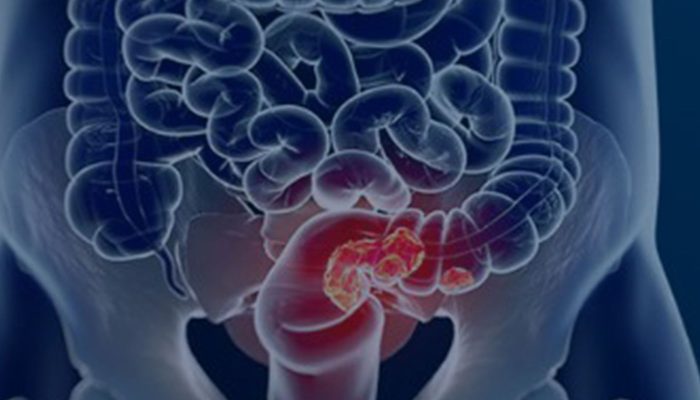 © Câmara Municipal de Afonso Claudio/Divulgação